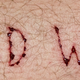 Illustration for article titled Next Week Is Deadspins Inaugural Blood Week: Submit A Story, Please